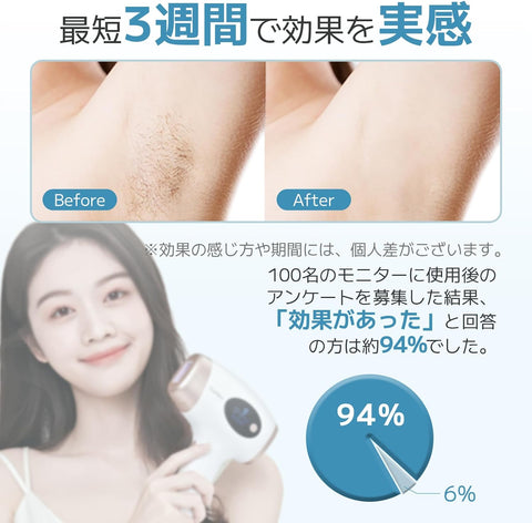 月額1,980円レンタルプラン：Sarlisi IPL光脱毛器 AI01 ホワイト – GYMGATE